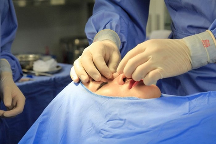 Xử lý đối với hành vi làm thẩm mỹ chui