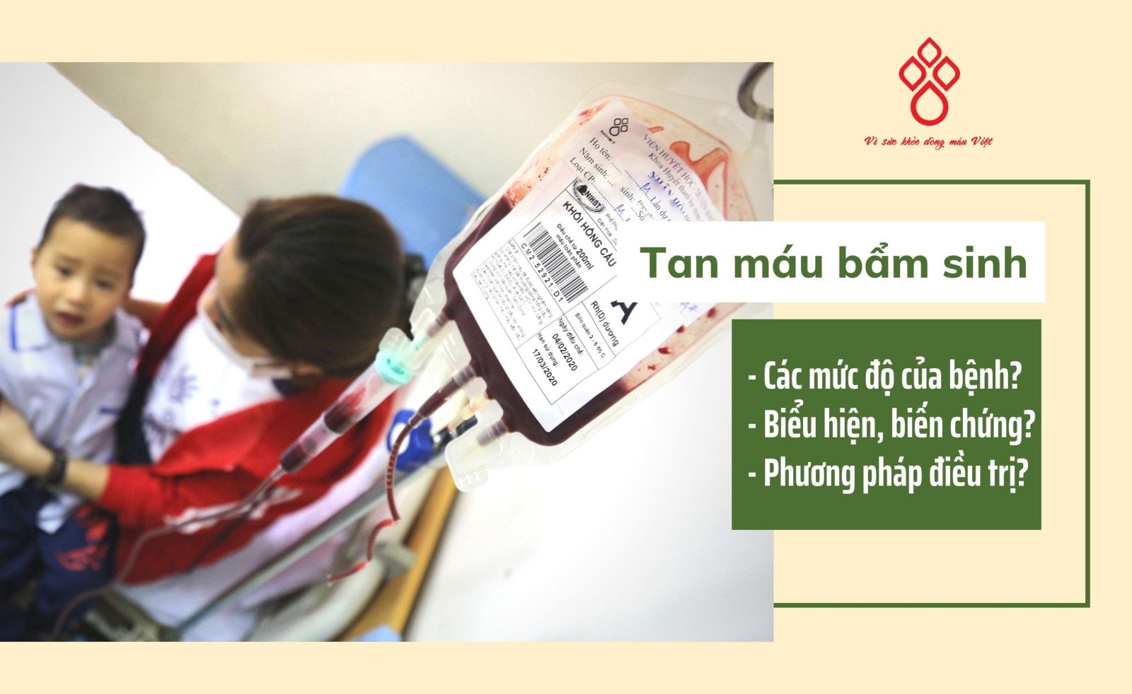 Tan máu bẩm sinh (thalassemia) là gì và điều trị như thế nào?
