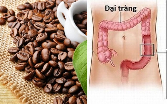 Thải độc đại tràng bằng cafe có đem lại lợi ích cho sức khỏe?