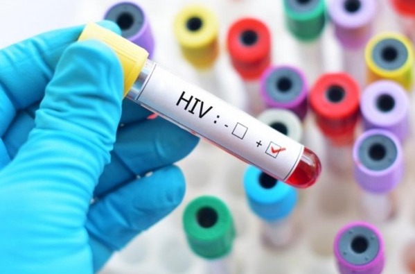 Xét nghiệm HIV qua Webside tránh tâm lý e ngại cho người bệnh