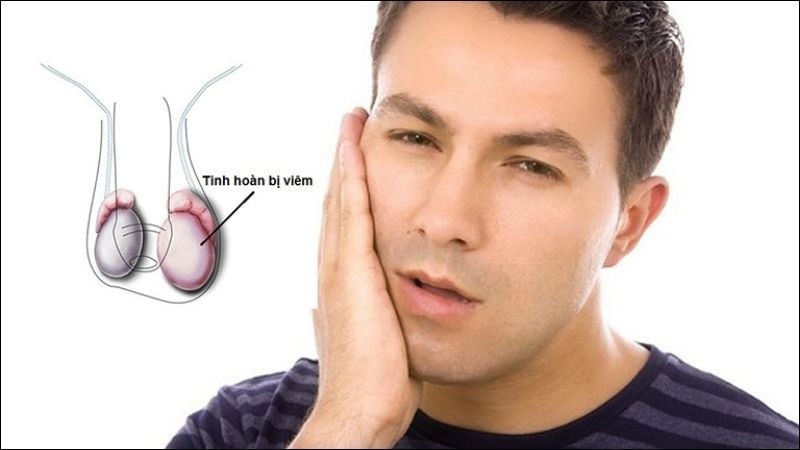 Mắc quai bị ở tuổi dậy thì cần chú ý gì để không bị teo tinh hoàn?