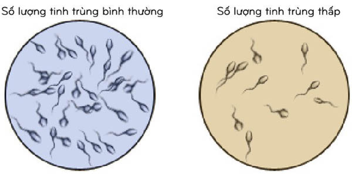 Làm gì để cải thiện tinh binh?