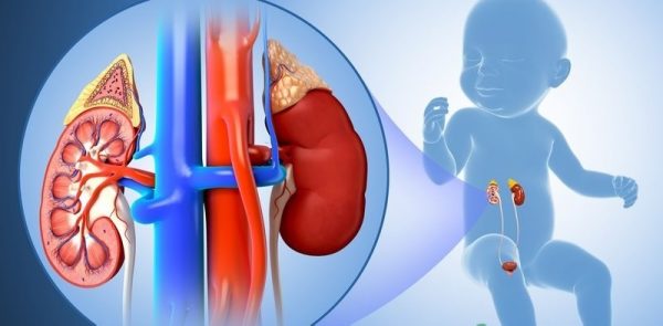 Những dấu hiệu suy thận mạn ở trẻ
