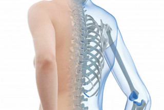 Tư vấn về bệnh loãng xương