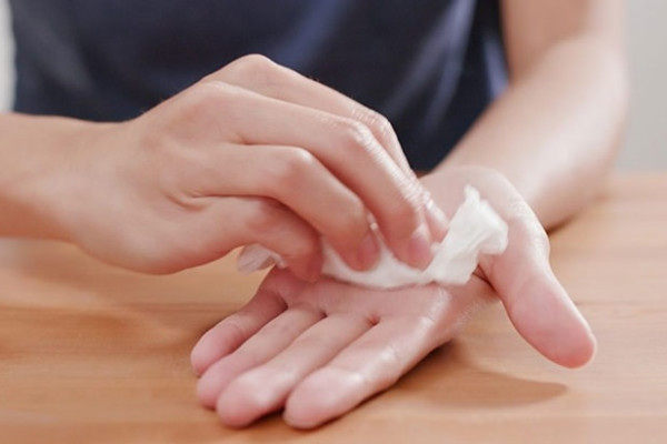 Tình trạng tăng tiết mồ hôi tay quá mức
