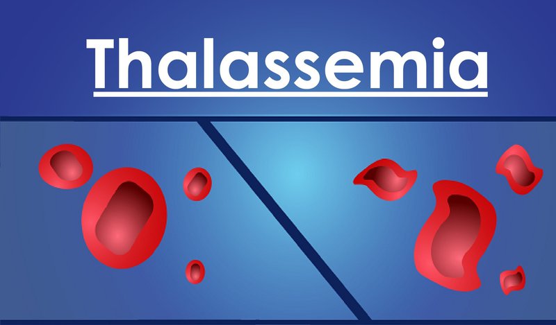 Bệnh tan máu bẩm sinh Thalassemia